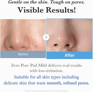 medicube Toner Pads Zero Pore Pad Mild 2.0 for Gentle Exfoliating